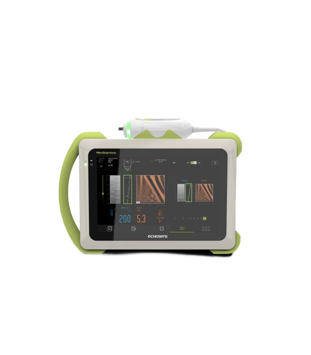 Máquina de examen de hígado de ultrasonido Fibroscan Mini Plus no invasiva de alta gama
