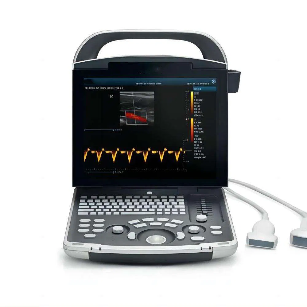 DP-30 Vista 1