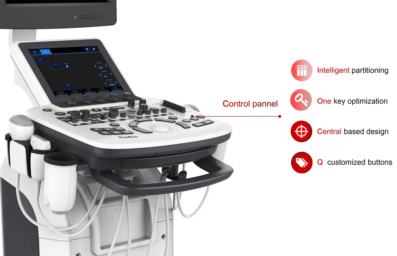 Ultrasonido Doppler Color
