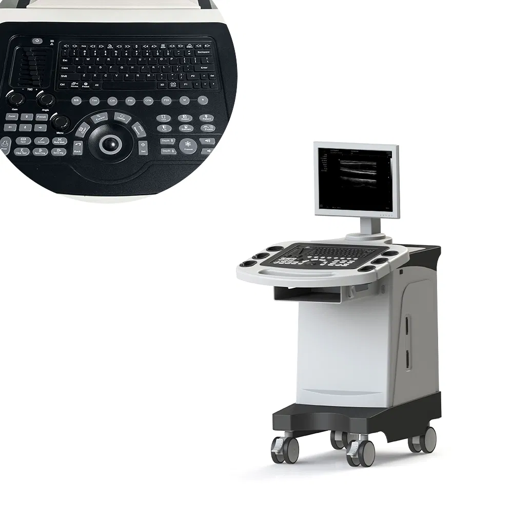 Sistema de Diagnóstico Totalmente Digital 4D Máquina de Ultrasonido Doppler Color en Carro