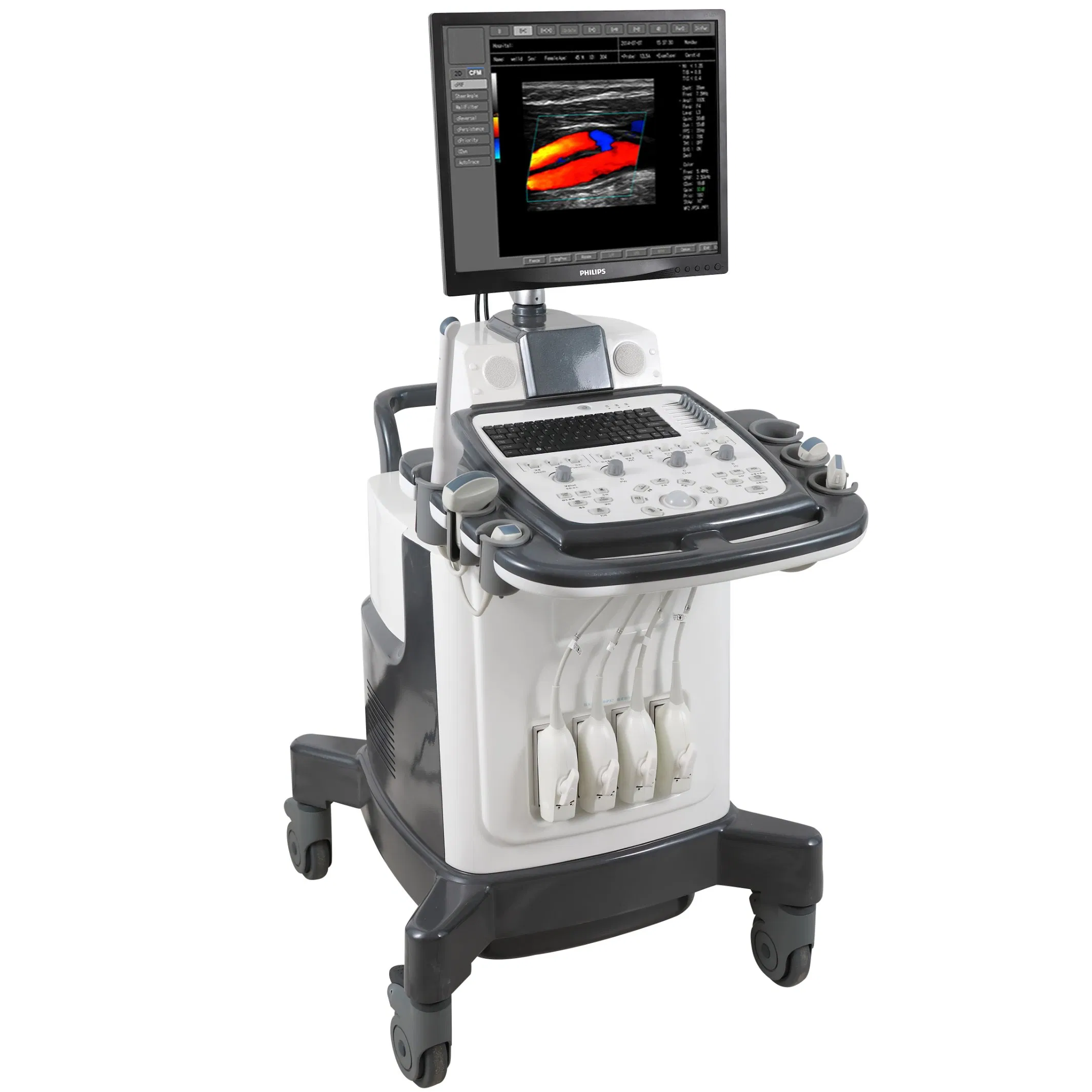 Sistema de Diagnóstico Médico Cardíaco Digital Hospitalario Escáner Ultrasónico Portátil 3D 4D 5D Máquina de Ultrasonido Doppler Color Trolley