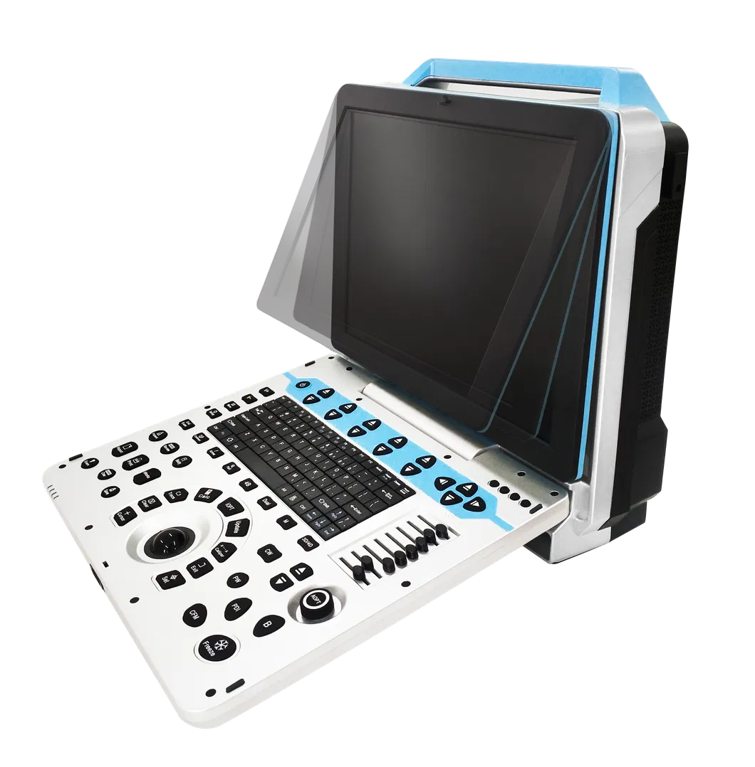 Ecografía Doppler 4