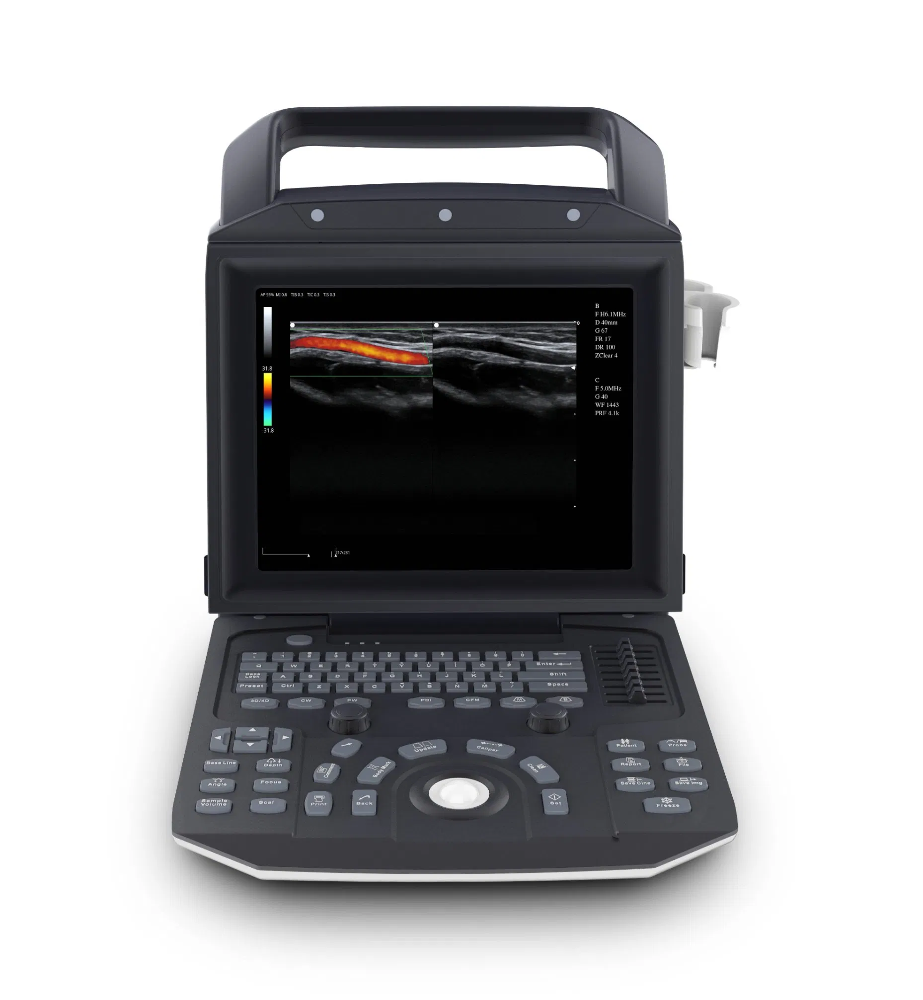 Escáner de Sonografía Mecan Medical Veterinary 12inch Máquina de Ultrasonido para Embarazo