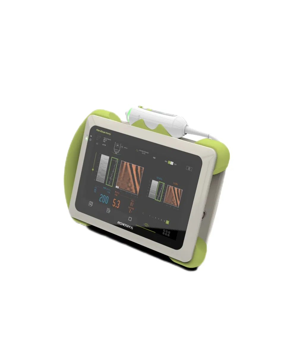 Máquina de examen de hígado de ultrasonido Fibroscan Mini Plus no invasiva de alta gama