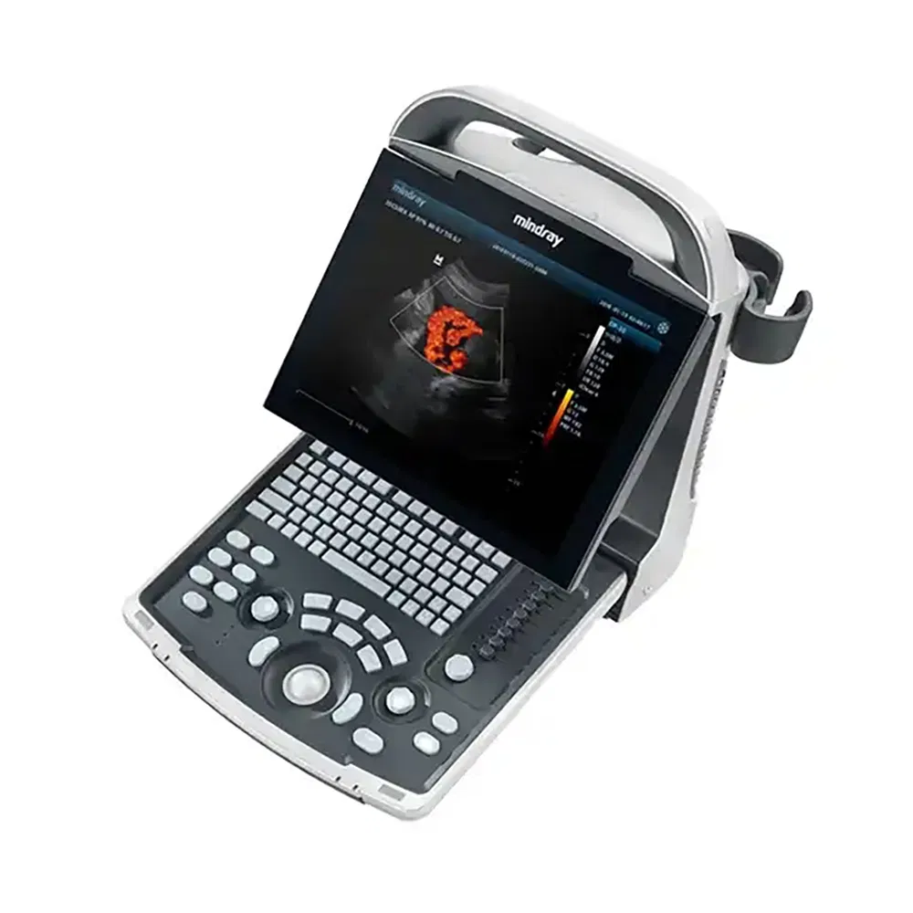 Instrumento de ultrasonido médico Mindray Dp30 Máquina de ultrasonido portátil Dp Dp-30 Blanco y negro Otro ultrasonido 30