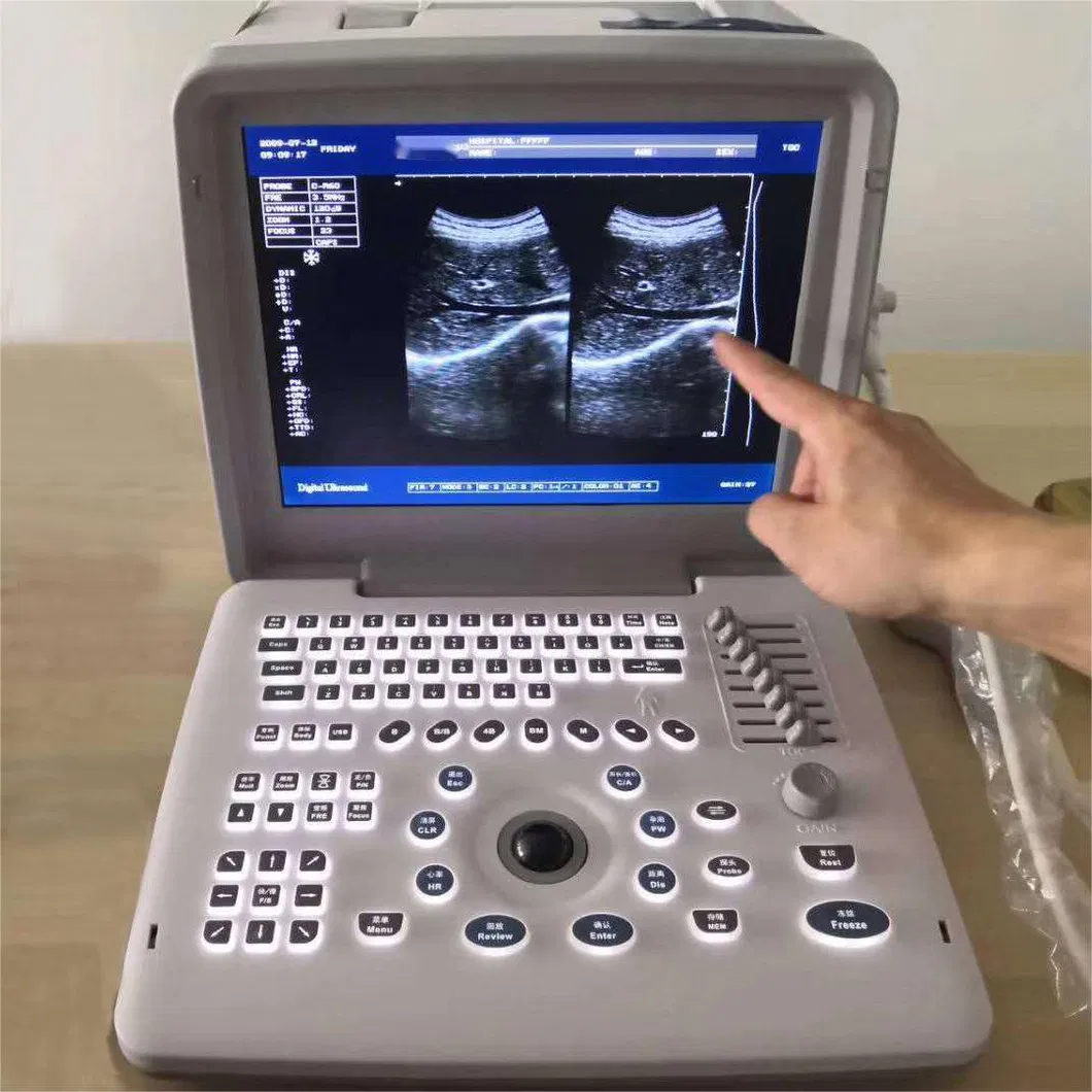 Ultrasonido diagnóstico 3