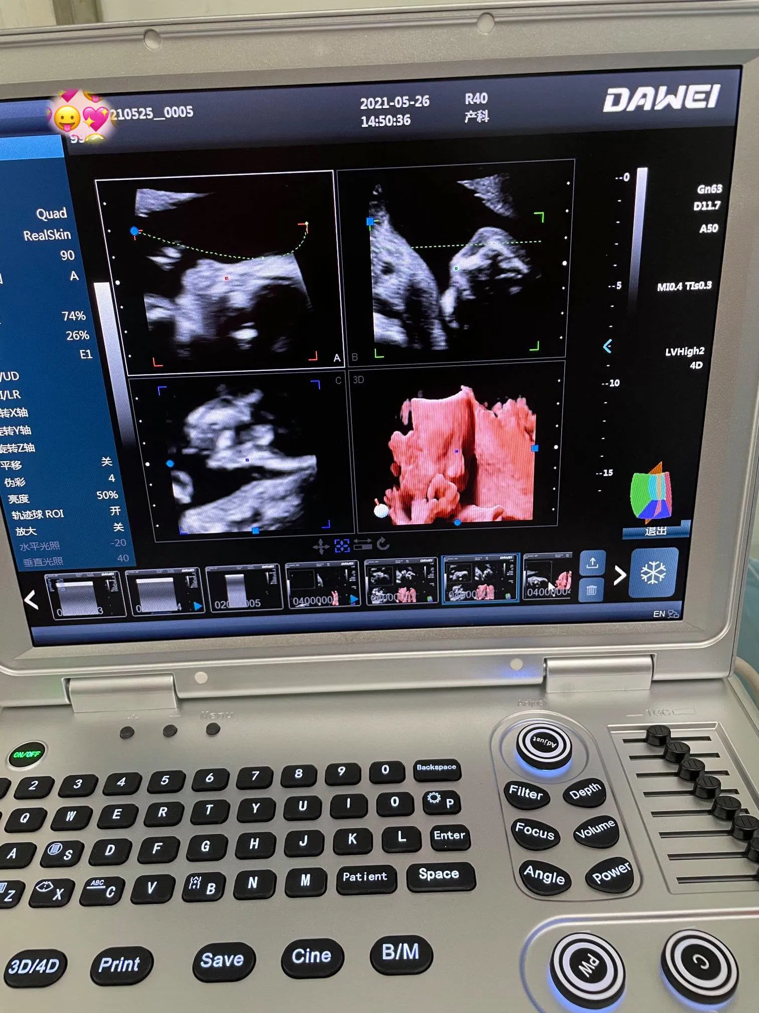 Máquina de ultrasonido portátil 3D/4D/5D Doppler color para obstetricia y ginecología