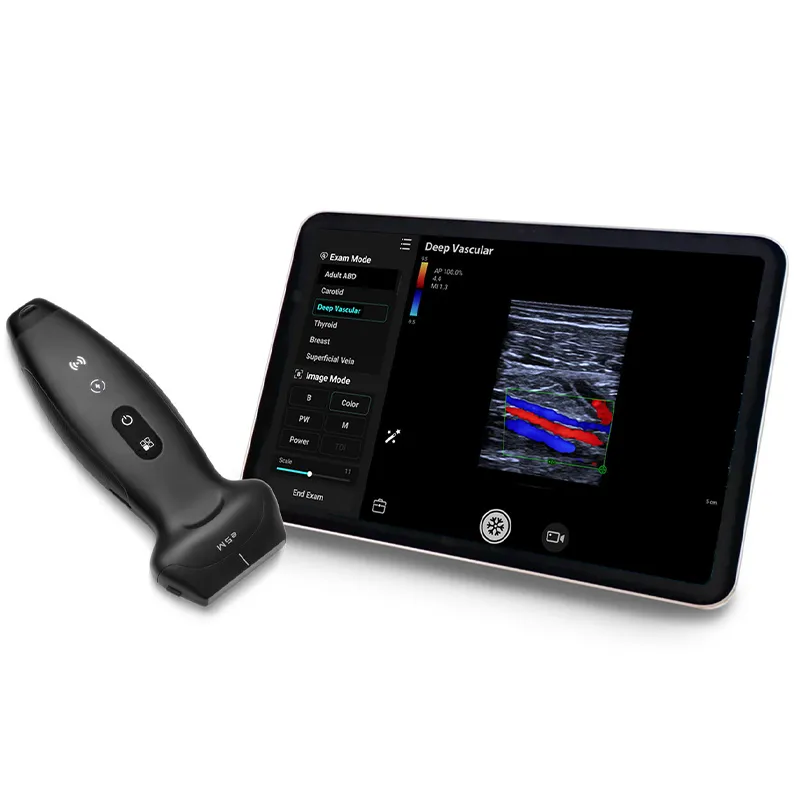 Ultrasonido Portátil