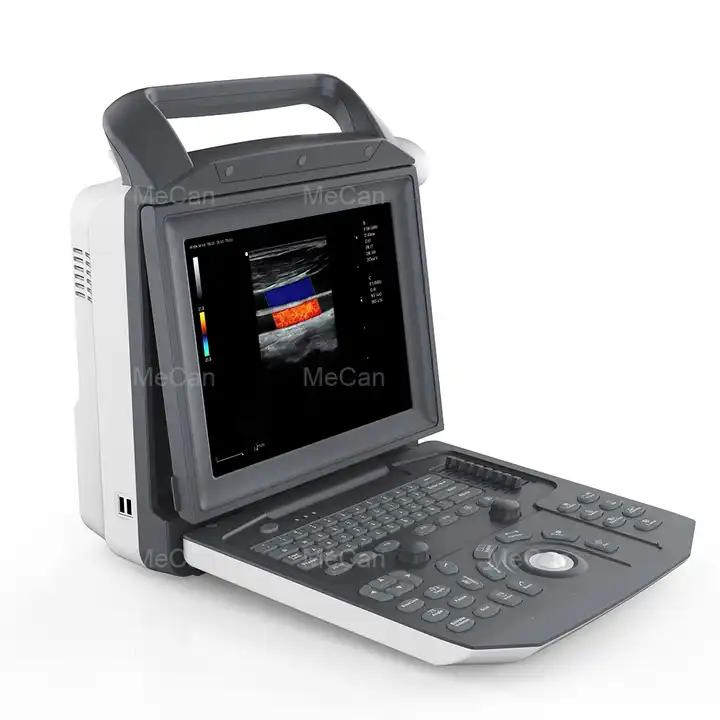 Sistema de escáner ultrasónico portátil de diagnóstico por ultrasonido Doppler color