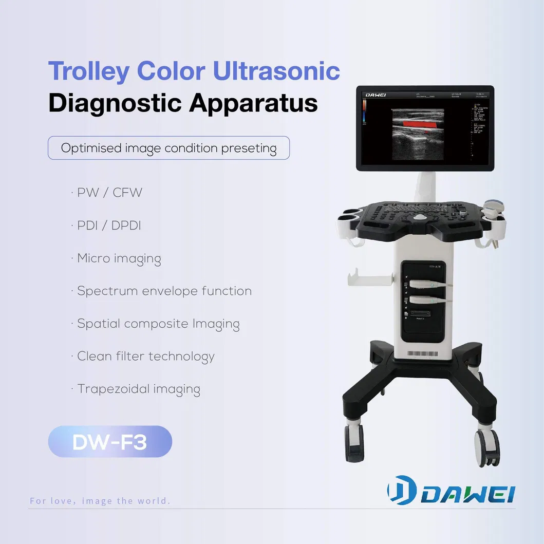 Ultrasonido Doppler 3