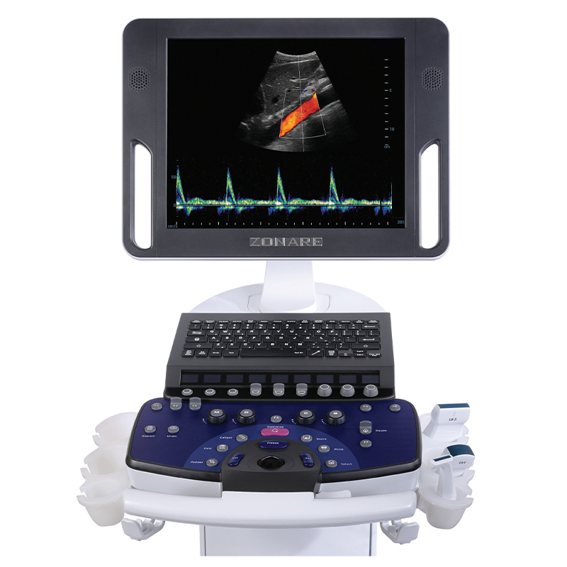 Sistema de ultrasonido Doppler color para abdomen y cardíaco de Mindray Z.One PRO para hospitales y clínicas