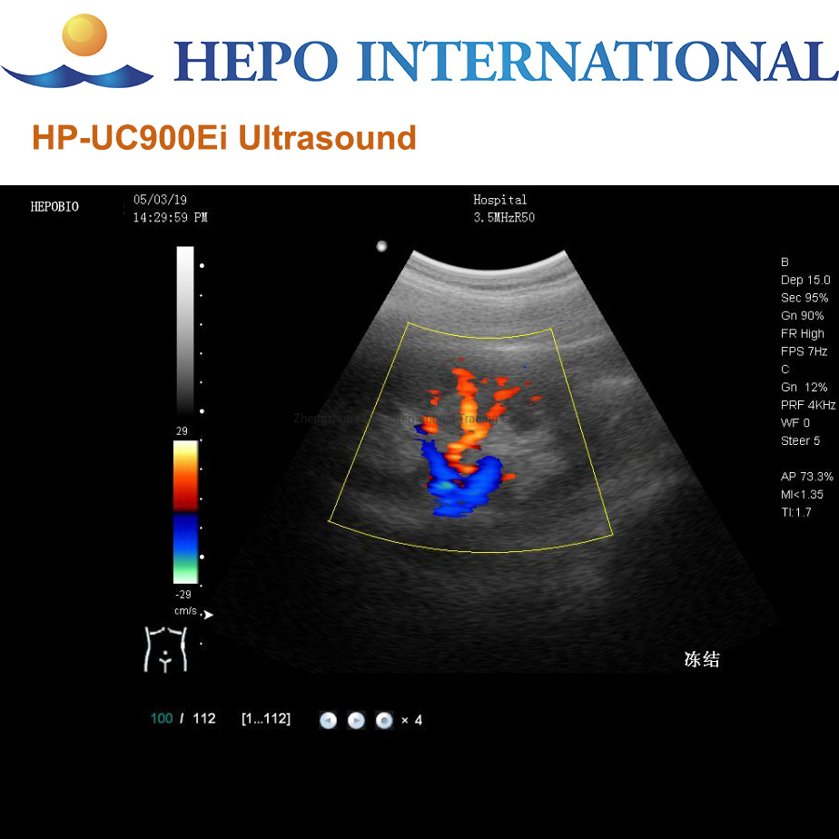360 Rotación de Grados Diagnóstico por Imágenes Médicas Máquina de Ultrasonido