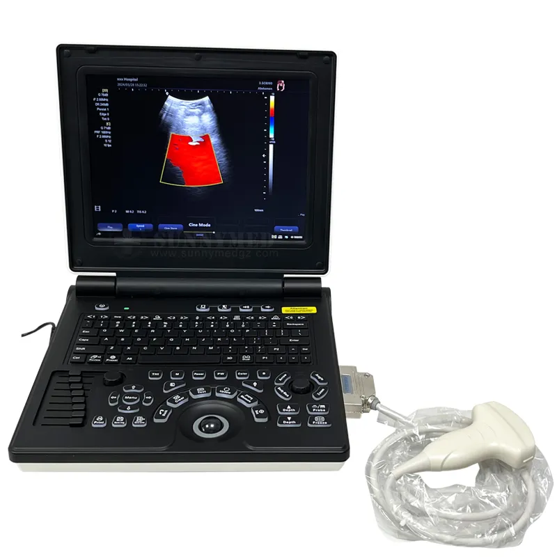 Diagnóstico Doppler 1
