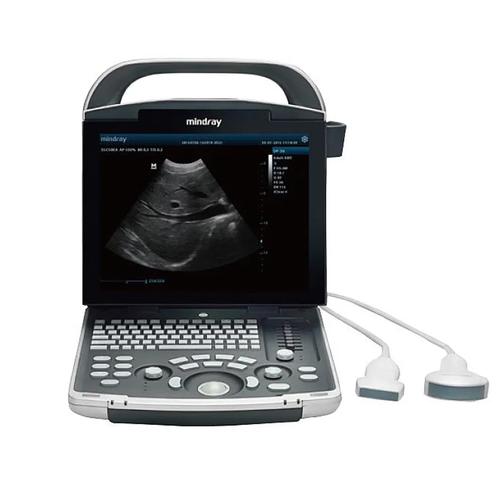Instrumento de ultrasonido médico Mindray Dp30 Máquina de ultrasonido portátil Dp Dp-30 Blanco y negro Otro ultrasonido 30