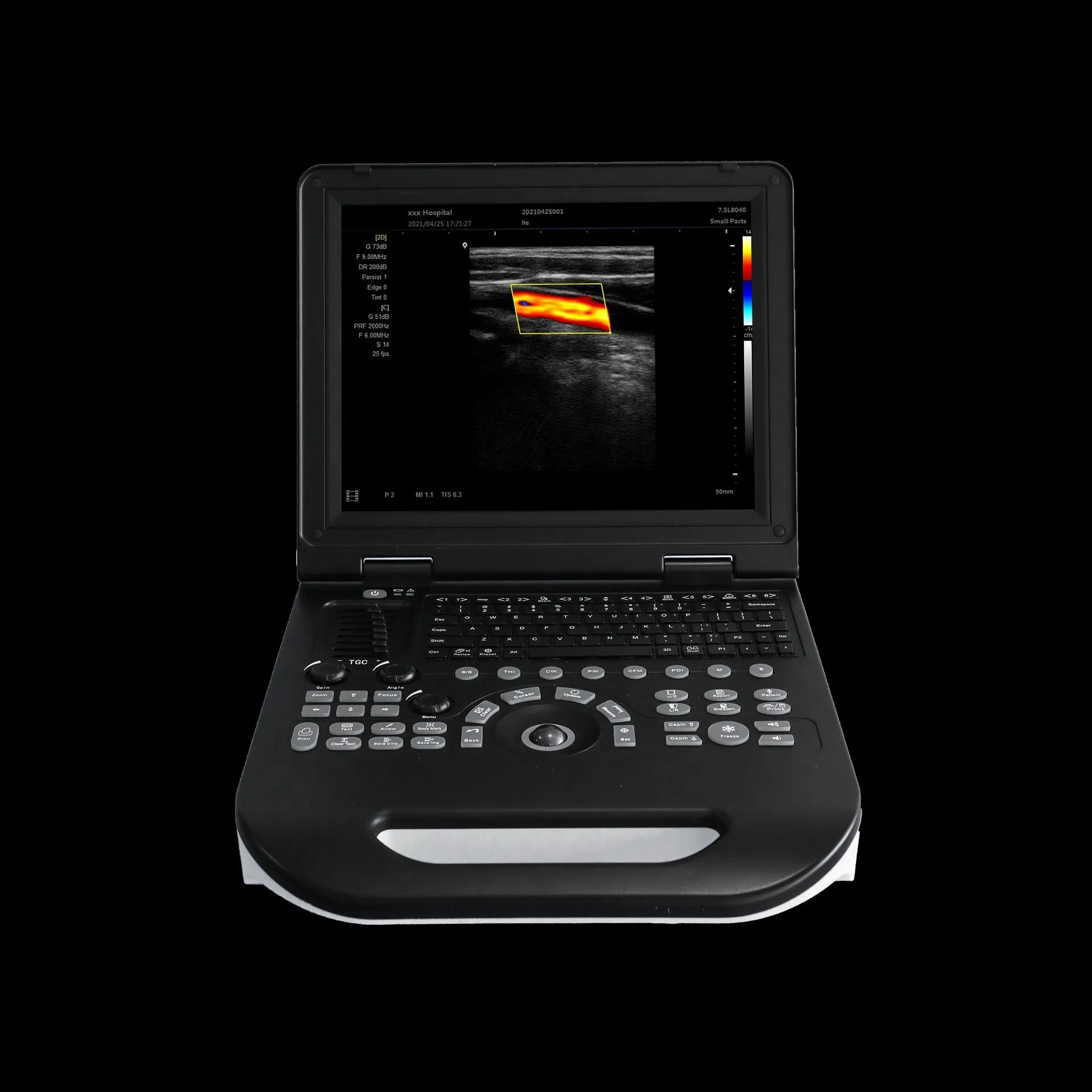 Sistema de Ultrasonido Innovador para Clínicas Médicas y Centros de Diagnóstico