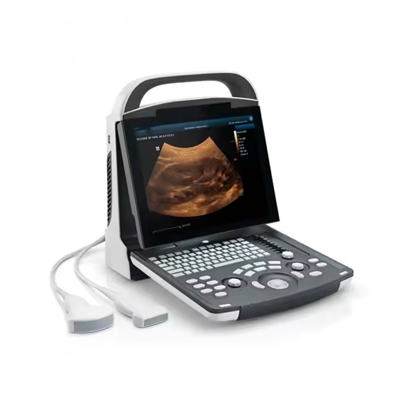 Mindray Portátil Dp30 Alta Resolución Compacto Color Doppler Eficiente Doppler Innovador Ultrasonido para Profesional Médico