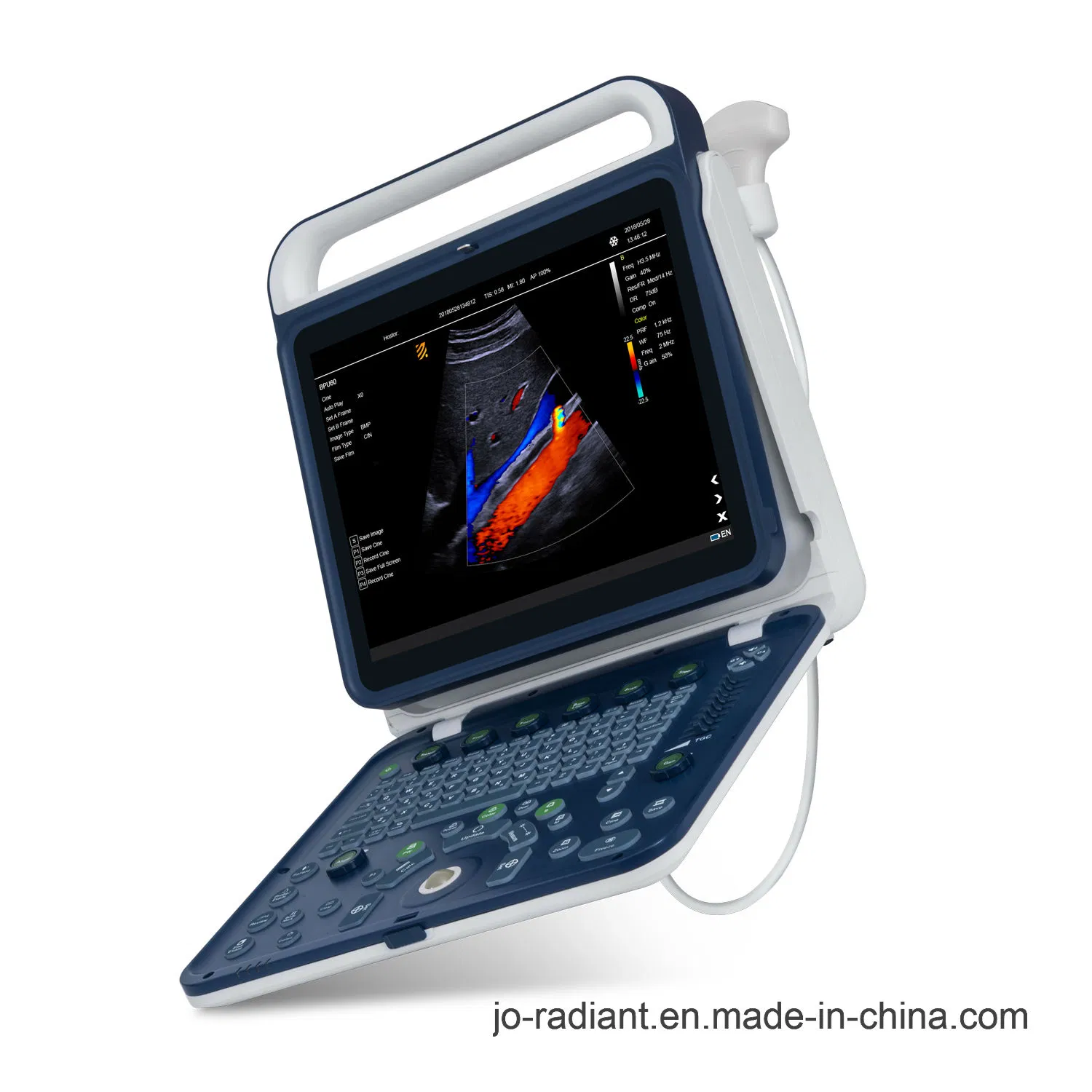 Sistema de escáner ultrasónico Doppler color portátil