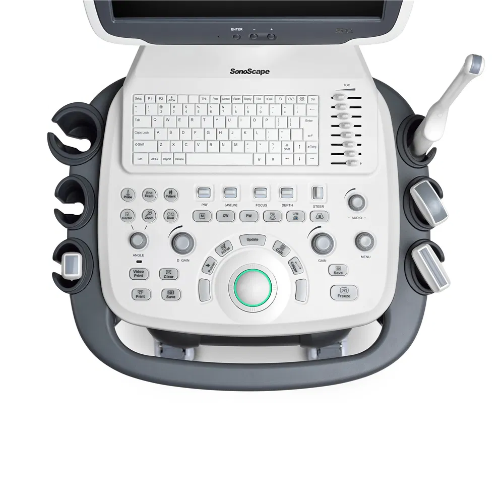 S12 Móvil Médico 3D/4D Máquina de Ultrasonido Doppler Color