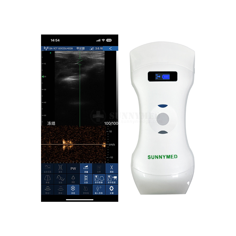 Sy-AC61_CPL 3 In1 (escáner ultrasónico inalámbrico con arreglo convexo, lineal y en fase todo en uno)