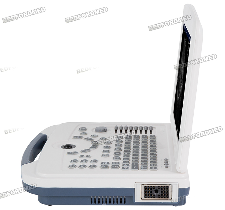 Máquina de Ultrasonido Médico en Blanco y Negro Sistema de Diagnóstico Ultrasonico Me-580 W1.0
