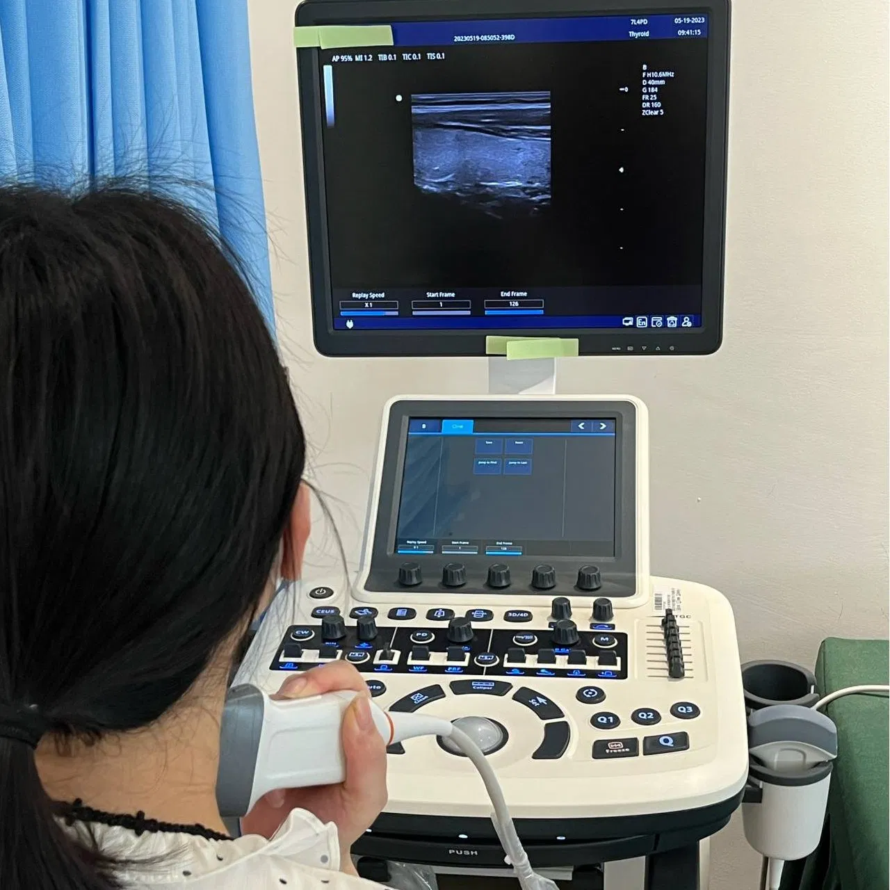 Monitor LCD de 3D/4D 15 pulgadas Sistema de Diagnóstico por Ultrasonido Doppler Color Médico