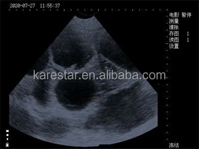 Calidad imagen 1