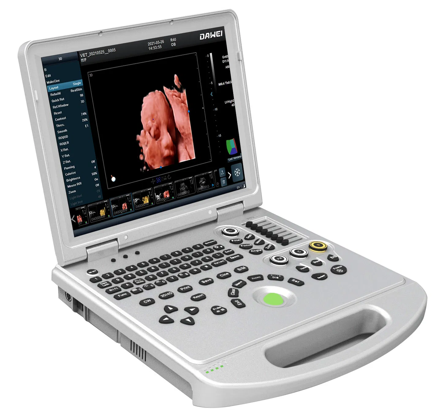 Máquina de ultrasonido portátil 3D/4D/5D Doppler color para obstetricia y ginecología