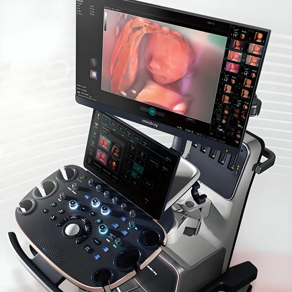Máquina de Ultrasonido Profesional para Embarazo Mindray Nuewa I9 con Doppler Color para Obstetricia y Ginecología