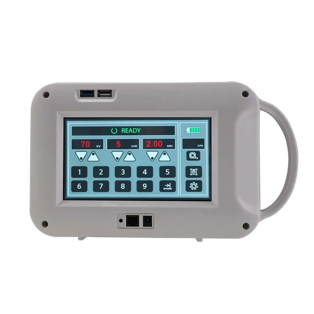 in-D705 Máquina de rayos X Escáner ultrasónico portátil Laboratorio Hospital Instrumento quirúrgico Diagnóstico Equipo médico oftálmico Proveedor