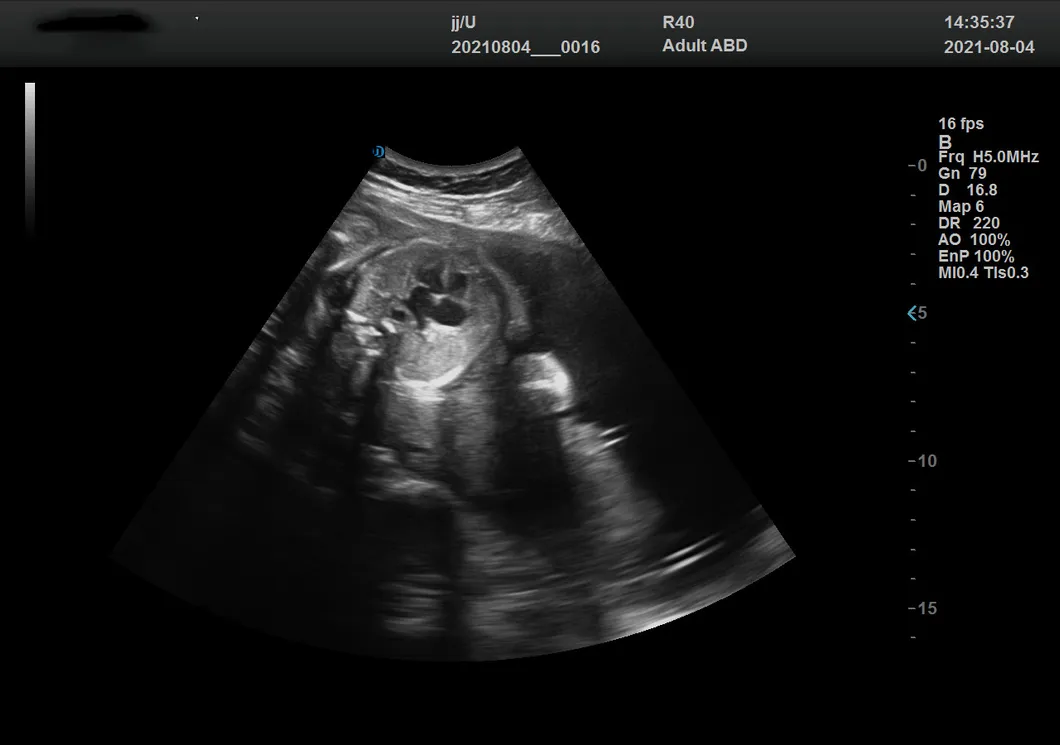 Corazón fetal
