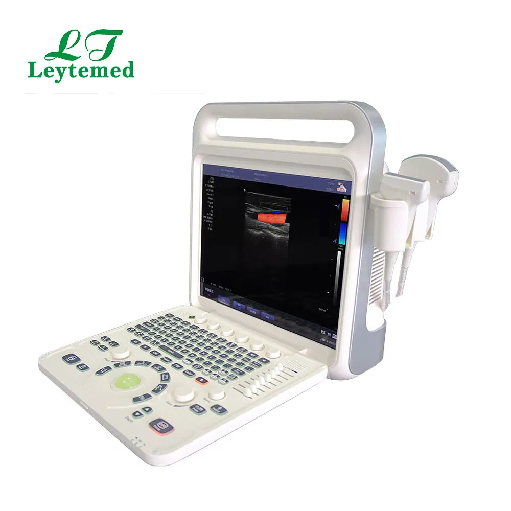 Ltub63 Urología Cardíaca Ginecología Obstetricia USG Doppler Color 4D Máquina de Ultrasonido