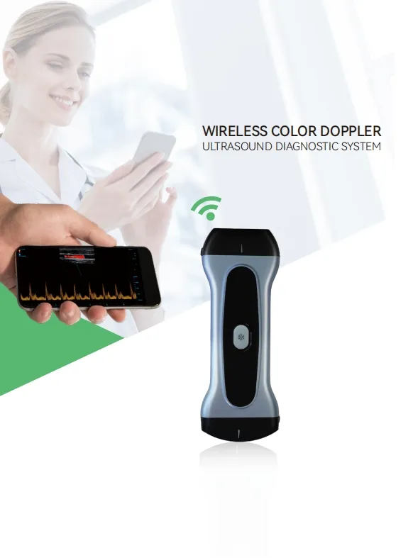 Escáner de ultrasonido Doppler color inalámbrico 1