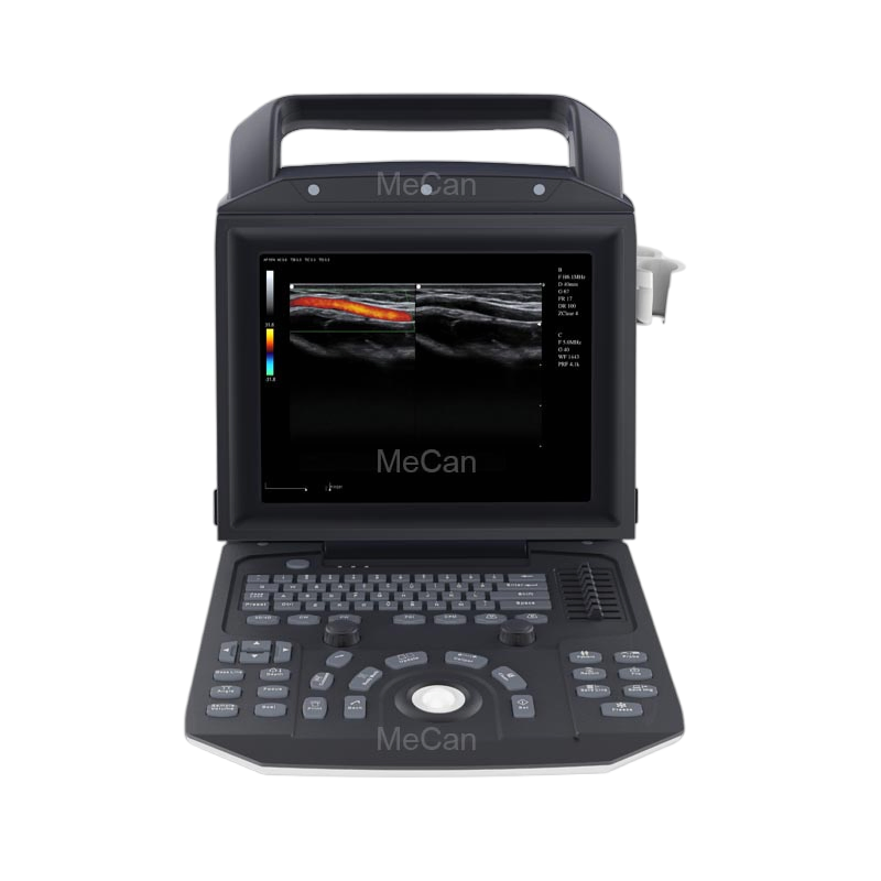 Venta Caliente Reparador de Sonda Doppler Vascular Cardiovascular de Abdomen Máquina de Ultrasonido Chison