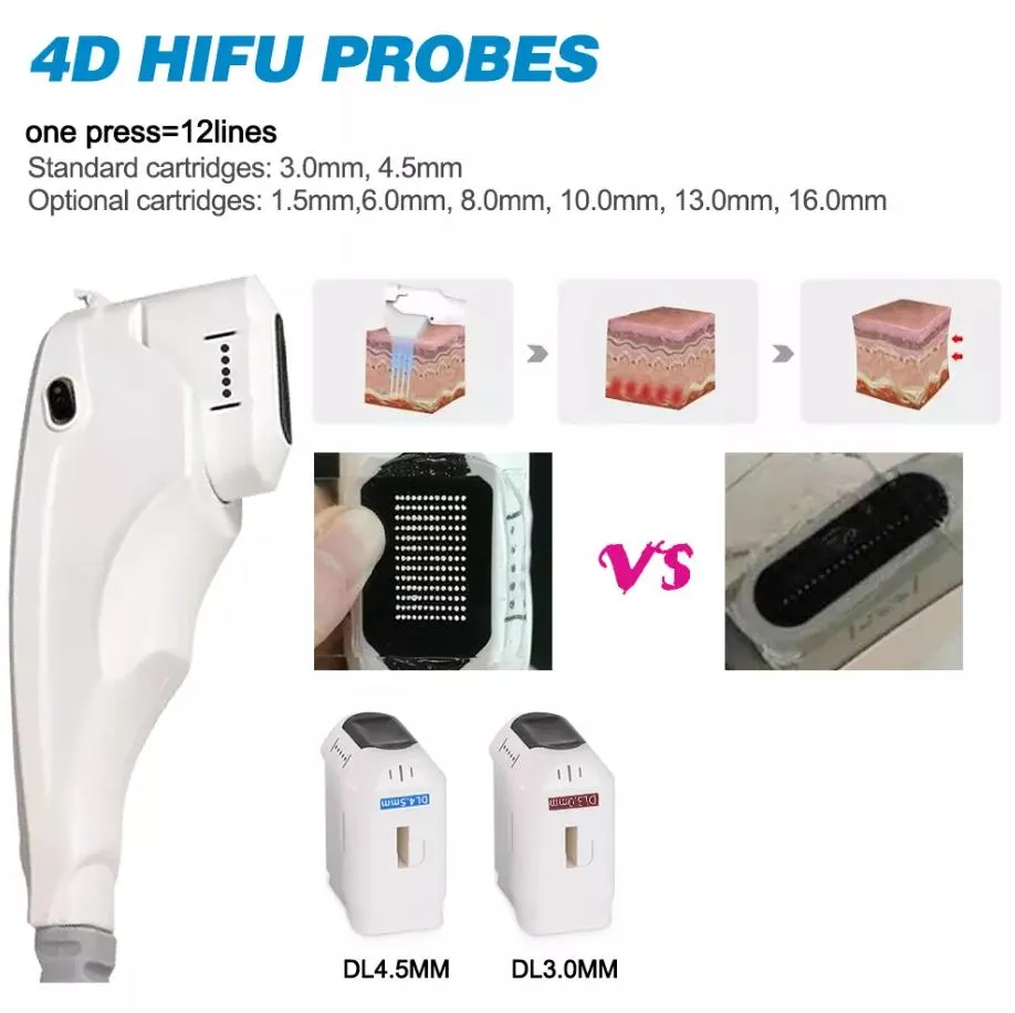Mango 4D HIFU