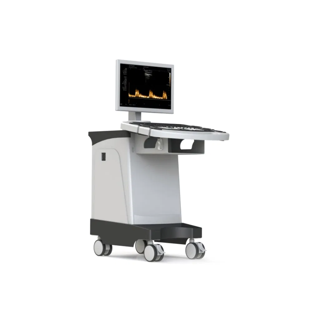 Sistema de Diagnóstico Totalmente Digital 4D Máquina de Ultrasonido Doppler Color en Carro