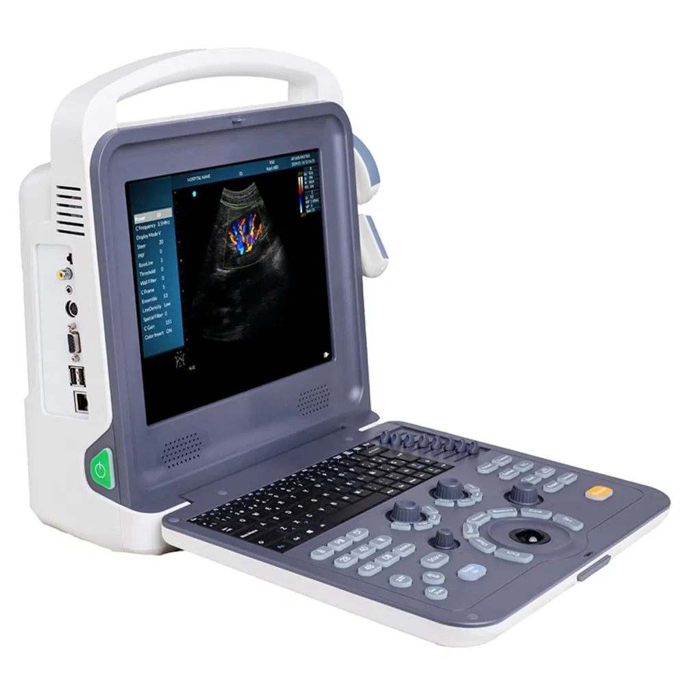 Precio de fábrica al por mayor sistema de diagnóstico ultrasónico Doppler color portátil digital completo