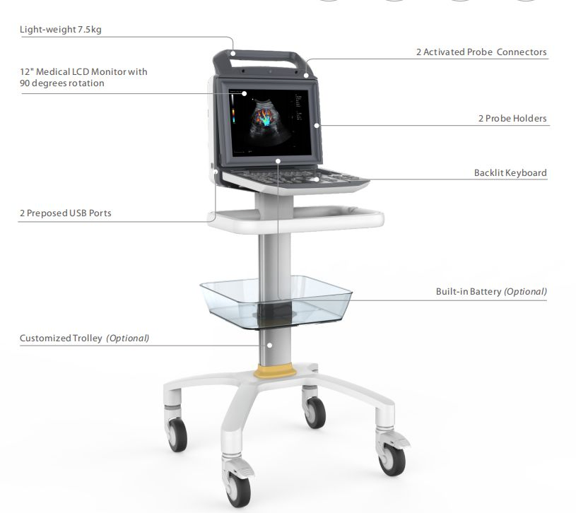 Venta Caliente Reparador de Sonda Doppler Vascular Cardiovascular de Abdomen Máquina de Ultrasonido Chison