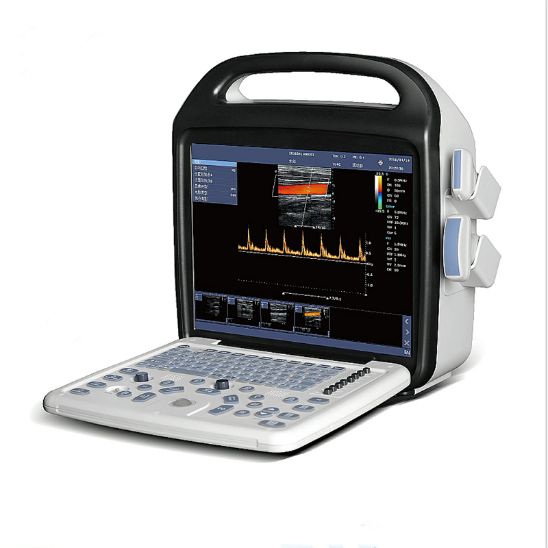Sistema de Diagnóstico por Ultrasonido Doppler Color C80