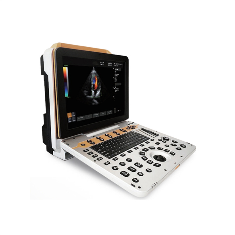 Máquina de ultrasonido diagnóstico portátil Doppler color de alta calidad de China