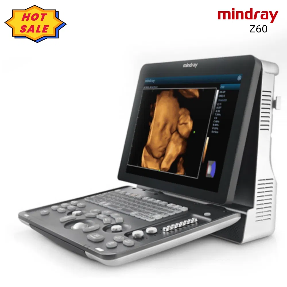 Z60 Mindray Dp-20 Escáner Ultrasónico Digital Portátil Completo Sistema de Diagnóstico