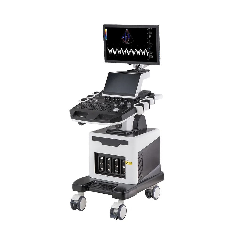 Ltub58 Precio de fábrica versión alta sistema de ultrasonido médico móvil de alta gama con carro