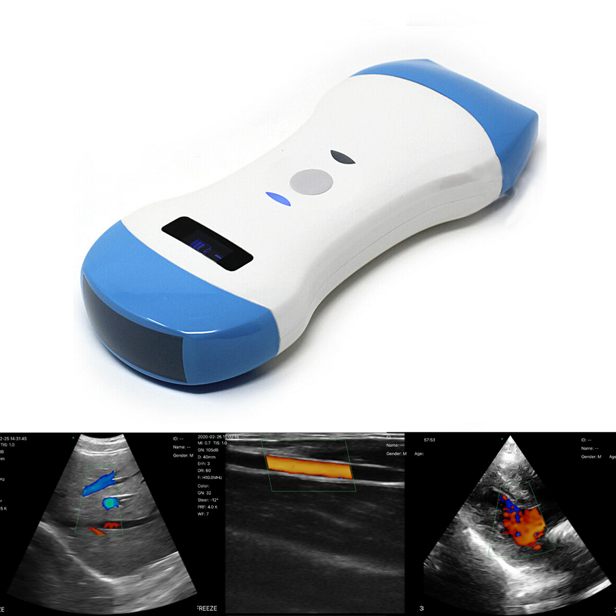 Escáner de ultrasonido portátil inalámbrico de mano con doble cabezal de color Doppler para smartphone tipo USB y WiFi