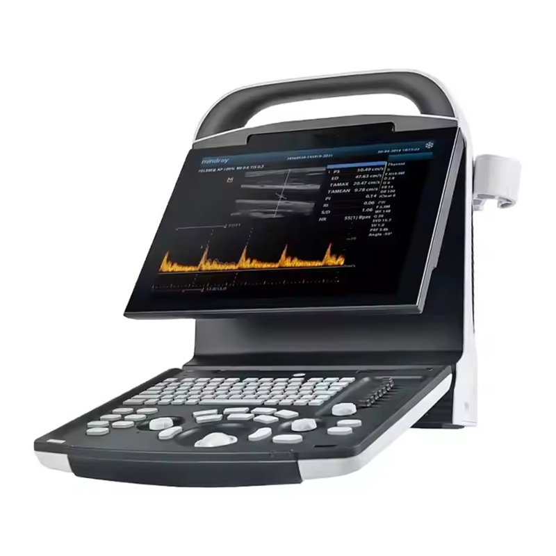 Mindray Portátil Dp30 Alta Resolución Compacto Color Doppler Eficiente Doppler Innovador Ultrasonido para Profesional Médico