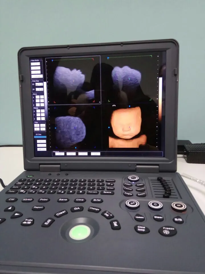 Detalle Doppler
