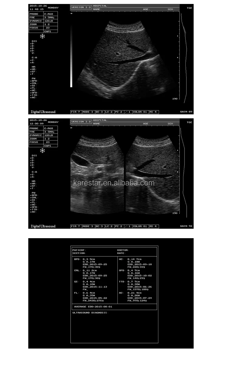 Calidad de imagen digital