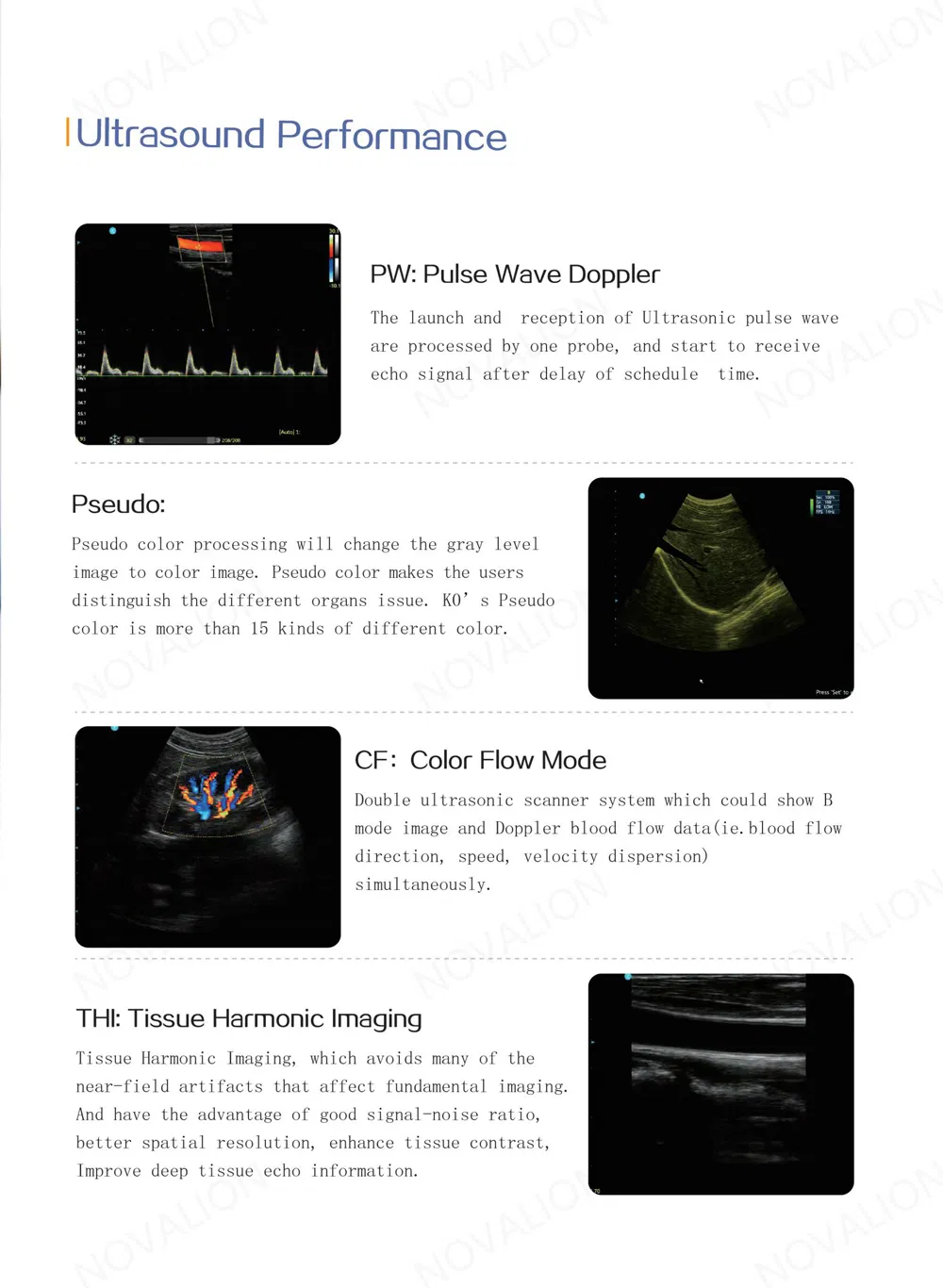 Detalle Doppler 2