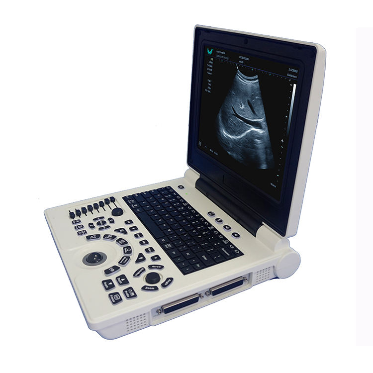 3D Ecografía Abdominal Escaneo Imagen Sonografía Ultrasonografía Sistema