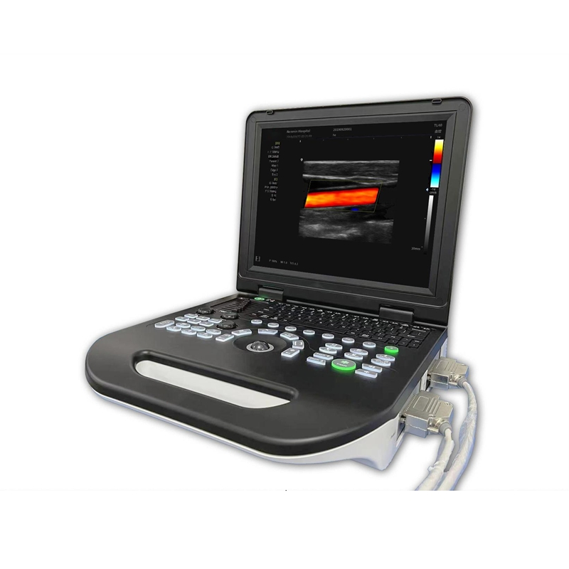 Umus031: Sistema de ultrasonido digital versátil con capacidades superiores de procesamiento de imágenes y almacenamiento