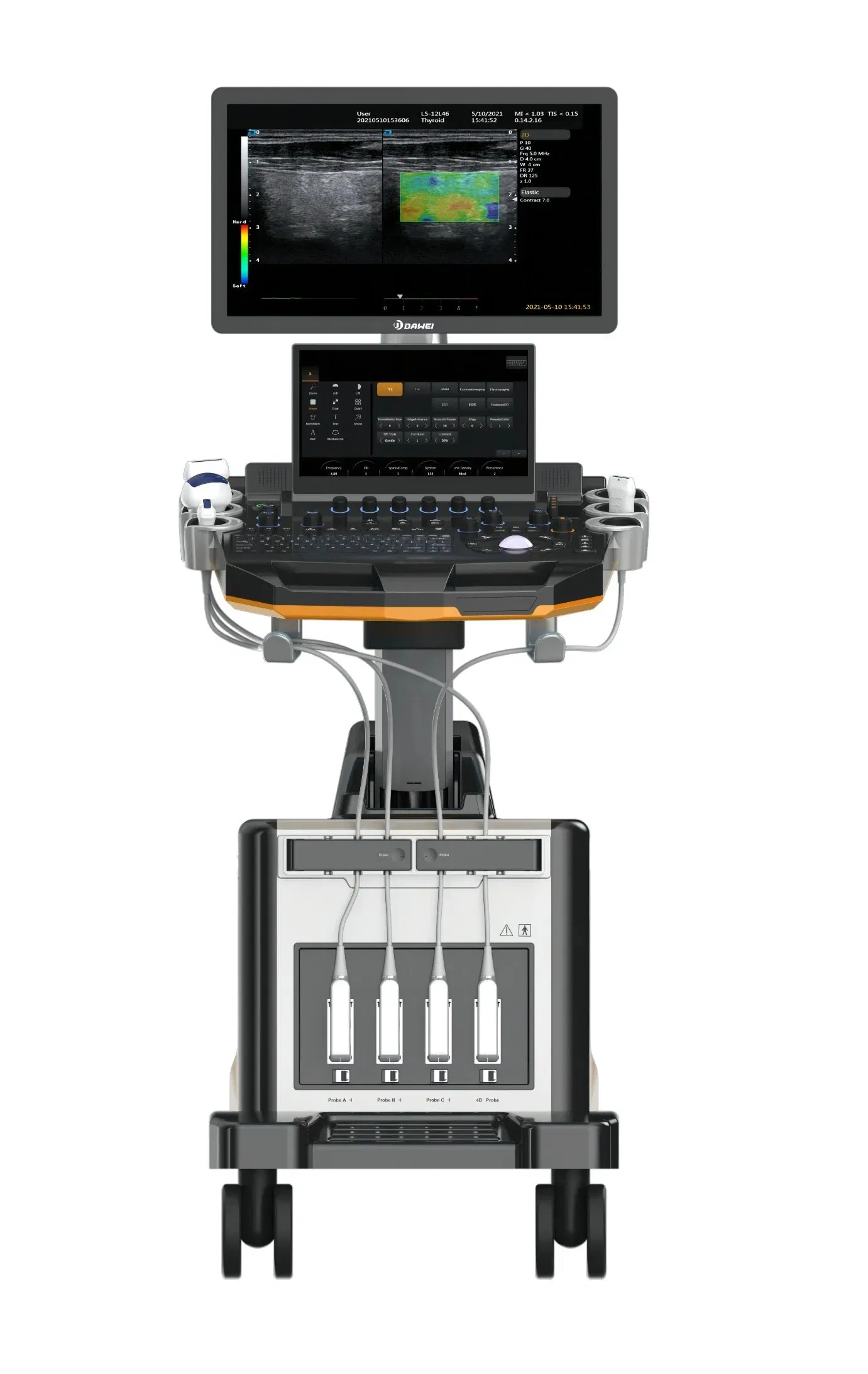 Sistema de Ultrasonido Avanzado 3D/4D con Doppler Color - Máquina de Imágenes Médicas