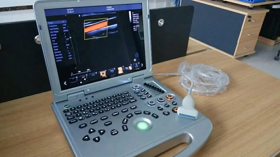 Máquina de ultrasonido médico portátil con Doppler color digital para el embarazo 3D/4D